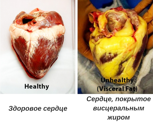 Чем опасен висцеральный жир?