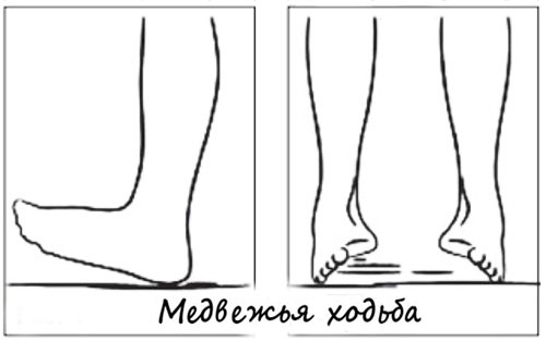 Медвежья ходьба