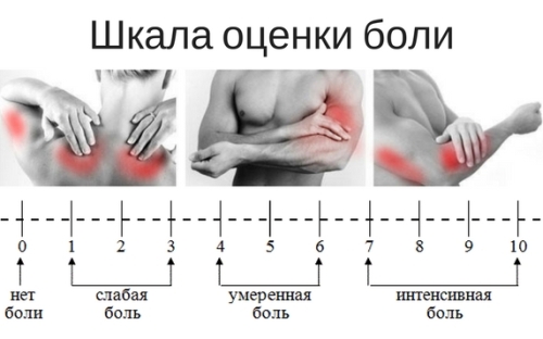 Можно ли тренироваться с крепатурой